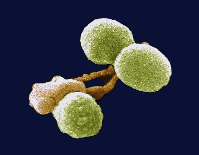 White blood cell attacking Streptococcus pneumoniae bacteria, SEM Coloured scanning electron micrograph  SEM  of Streptococcus pneumoniae bacteria  green  being attacked by a white blood cell  orange . S. pneumoniae is a leading cause of pneumonia, which particularly affects the young and old, or otherwise immunocompromised people. It also causes middle ear infections  otitis media . Antibiotics are typically used to treat these infections., by CDC, NIAID SCIENCE PHOTO LIBRARY