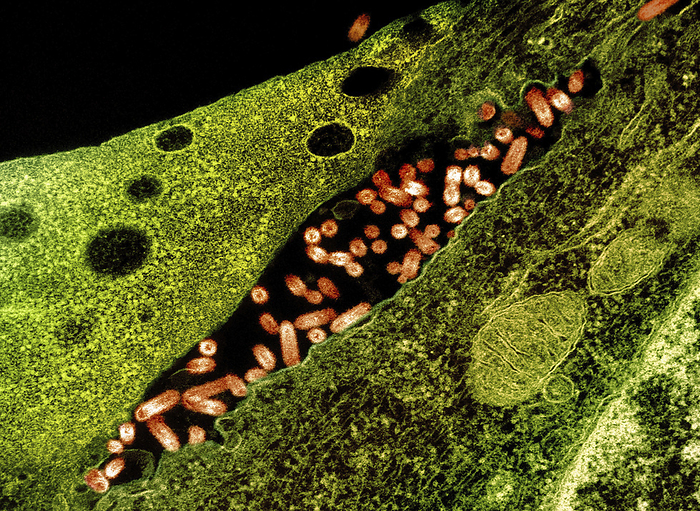 Vesicular stomatitis virus infection, TEM Transmission electron micrograph  TEM  showing vesicular stomatitis virus  VSV  particles  orange  budding from infected cells  green . VSV primarily infects horses, pigs and cattle, causing lesions to form in the mouth, tongue, lips, nostrils, and hooves. Discomfort due to these lesions can cause animals to refuse to eat, resulting in malnourishment. VSV can be transmitted to humans where it causes flu like symptoms. Treatment typically involves antibiotics., by NIAID SCIENCE PHOTO LIBRARY