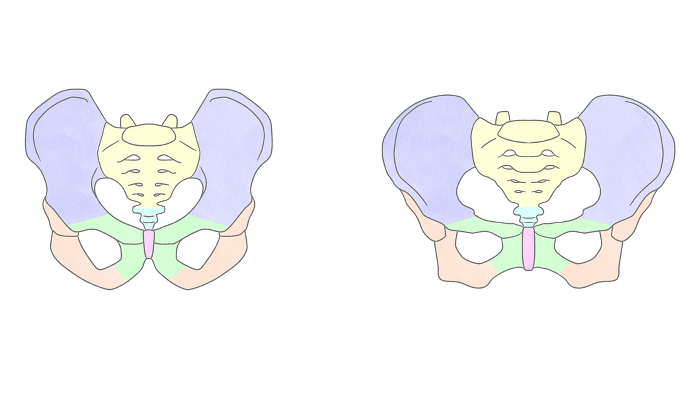 Comparison of male and female pelvic bones Easy-to-understand graphic illustrations