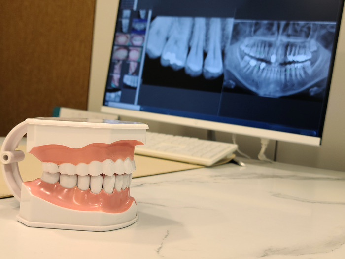 dental x ray image, tooth model in hospital