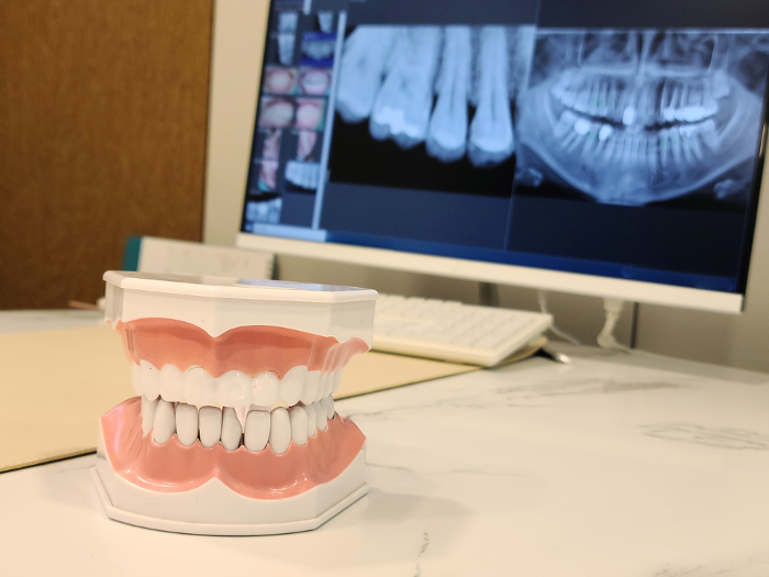 dental x ray image, tooth model in hospital