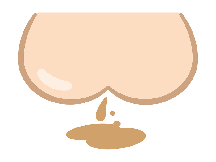 Clip art of buttocks and diarrhea