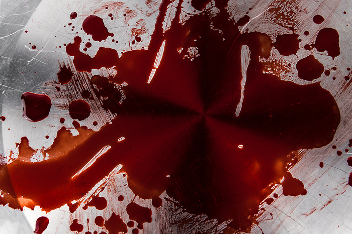 Blood on a metal plate Blood on a metal plate, by Zoonar Christoph Sch