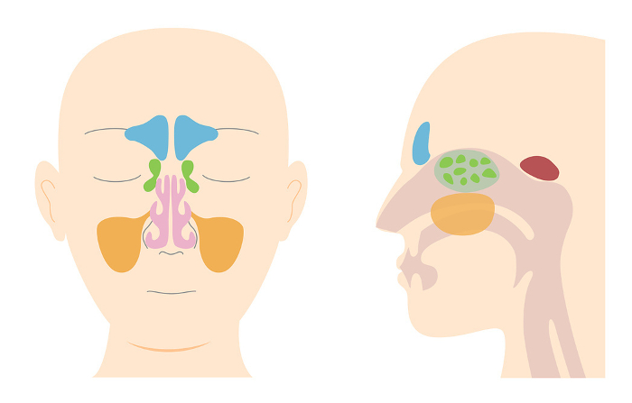 Anatomical illustration of the head with the paranasal sinuses viewed from the front and from the side (sagittal plane)