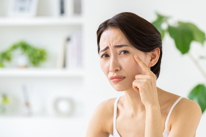 Middle Japanese woman suffering from skin problems (People)