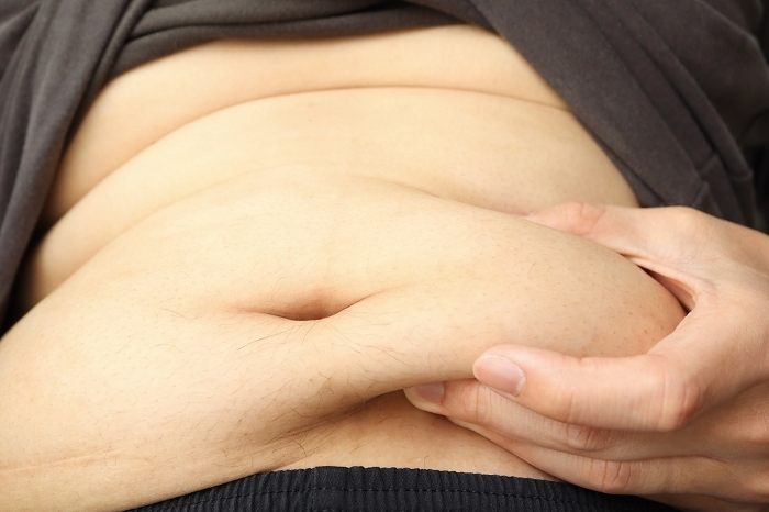 Obese male belly
