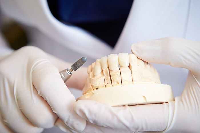 A man's hand shaving a denture at the dental lab bar.