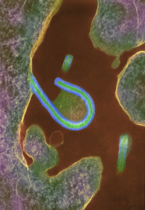 Ebola virus  Date and time of photograph unknown  Ebola virus. Coloured transmission electron micrograph  TEM  of the extrusion  release  of an Ebola virus  blue  from a host cell  green pink . This filovirus, which causes Ebola fever, removes part of the host s membrane  green brown, centre  as it leaves, ensuring that the host s defences do not recognise it as foreign. Ebola is contracted by handling material from infected animals, or through contact with the body fluids of infected patients. It causes a fever, severe haemorrhaging and central nervous system damage. There is no cure, but most victims recover if given good supportive therapy. Magnification unknown.