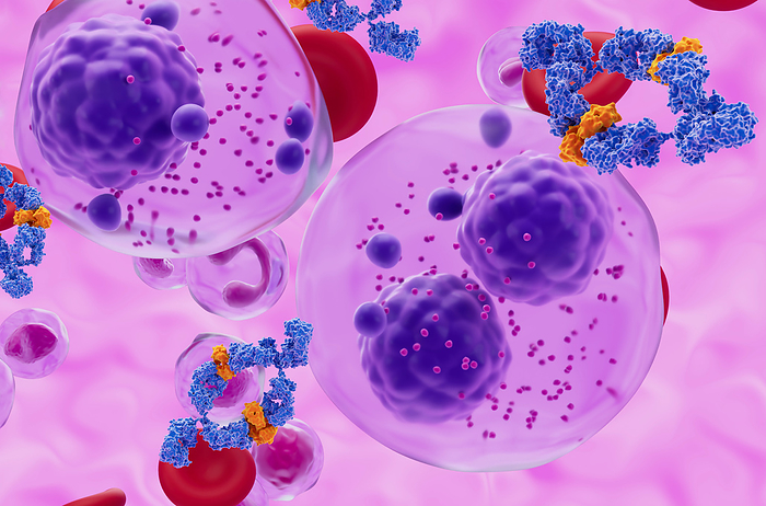 Monoclonal antibody treatment of multiple myeloma cell, illustration Illustration of a human monoclonal antibody drug  blue and orange  and multiple myeloma cells  purple . Multiple myeloma is type of cancer, it occurs when a plasma cell becomes abnormal and cancerous. The cancerous plasma cell divides and multiplies creating large amounts of abnormal antibodies., by NEMES LASZLO SCIENCE PHOTO LIBRARY