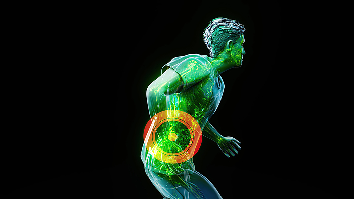 Back pain, conceptual illustration Back pain, conceptual illustration., by JULIEN TROMEUR SCIENCE PHOTO LIBRARY