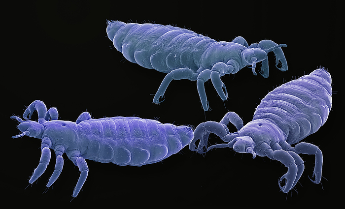 Head lice, SEM Head lice. Coloured scanning electron micrograph  SEM  of head lice  Pediculus humanus capitis . The head louse is parasitic insect which inhabits the hair of the head, gluing its eggs  called nits  to the shafts of individual hairs. It lives on blood, which it sucks from the scalp. The wounds left by the lice cause intense itching, which can lead to dermatitis and infection. The problems are compounded by reflex scratching of the bites. The lice can spread from head to head by close contact. Lice and nits can be killed with medicated shampoos. Magnification: x10 when printed 10 centimetres wide., by STEVE GSCHMEISSNER SCIENCE PHOTO LIBRARY