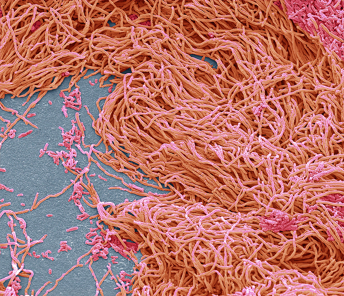 Faecal bacteria, SEM Faecal bacteria. Scanning electron micrograph  SEM  of bacteria cultured from a sample of human faeces. At least 50 per cent of human faeces is made up of bacteria shed from the gut. Many of these bacteria are a normal part of the flora found in the intestines and are beneficial to digestion. However, some are pathogenic, such as Salmonella enterica and certain strains of Escherichia coli, which can cause foodborne illnesses. Magnification: x1500 when printed 10 centimetres wide., by STEVE GSCHMEISSNER SCIENCE PHOTO LIBRARY