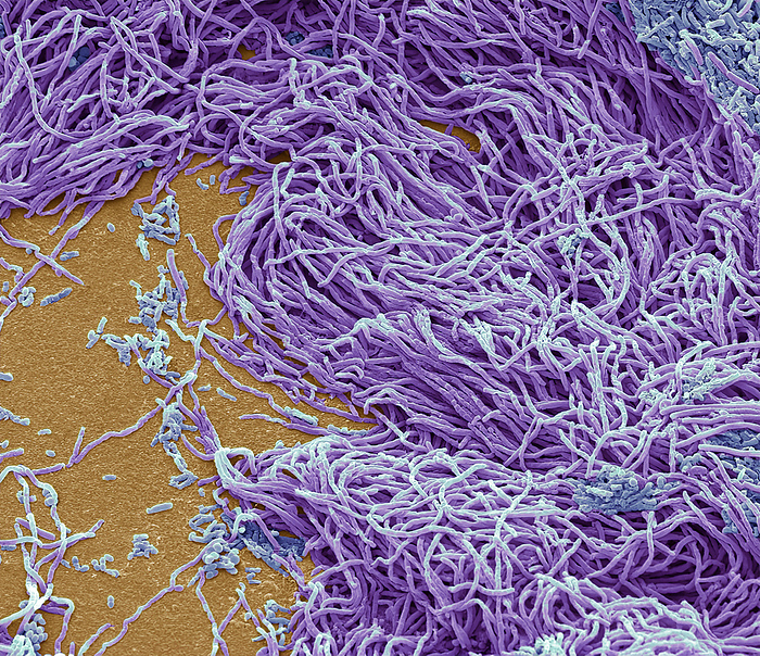 Faecal bacteria, SEM Faecal bacteria. Scanning electron micrograph  SEM  of bacteria cultured from a sample of human faeces. At least 50 per cent of human faeces is made up of bacteria shed from the gut. Many of these bacteria are a normal part of the flora found in the intestines and are beneficial to digestion. However, some are pathogenic, such as Salmonella enterica and certain strains of Escherichia coli, which can cause foodborne illnesses. Magnification: x1500 when printed 10 centimetres wide., by STEVE GSCHMEISSNER SCIENCE PHOTO LIBRARY