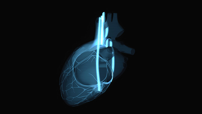 Heart scan, conceptual illustration Heart scan, conceptual illustration., by JULIEN TROMEUR SCIENCE PHOTO LIBRARY