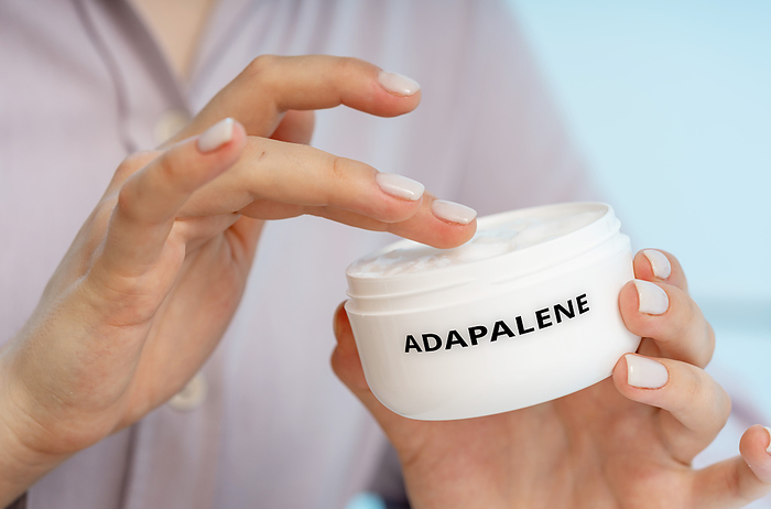 Adapalene medical cream, conceptual image Adapalene medical cream, conceptual image. A retinoid cream used to treat acne by unclogging pores and preventing the formation of new pimples., by Wladimir Bulgar SCIENCE PHOTO LIBRARY
