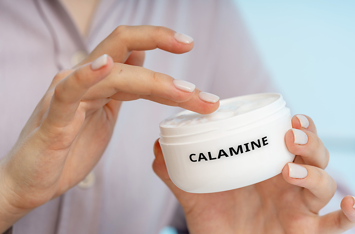 Calamine medical cream, conceptual image Calamine medical cream, conceptual image. A soothing cream used to relieve itching, irritation, and minor skin conditions like poison ivy, insect bites, and sunburn., by Wladimir Bulgar SCIENCE PHOTO LIBRARY