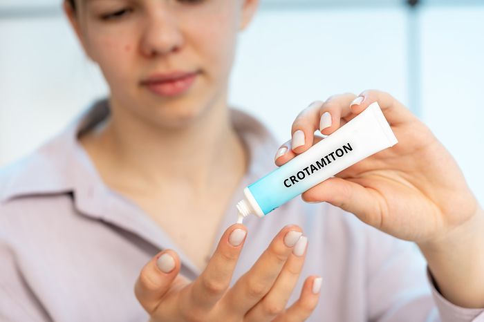 Crotamiton medical cream, conceptual image Crotamiton medical cream, conceptual image. A cream used to treat scabies and relieve itching caused by various skin conditions, including eczema and insect bites., by Wladimir Bulgar SCIENCE PHOTO LIBRARY