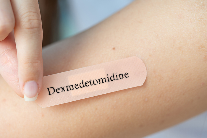 Dexmedetomidine transdermal patch, conceptual image Dexmedetomidine transdermal patch, conceptual image. Alpha 2 adrenergic agonist used for sedation and anaesthesia., by Wladimir Bulgar SCIENCE PHOTO LIBRARY