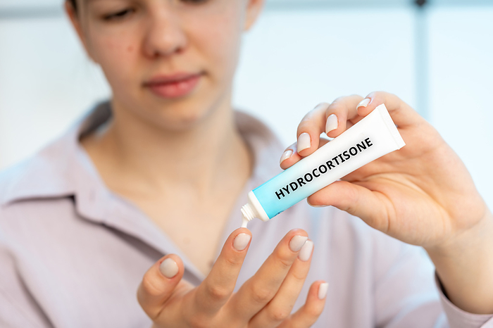 Hydrocortisone medical cream, conceptual image Hydrocortisone medical cream, conceptual image. A combination cream used to treat fungal skin infections with inflammation and itching, such as athlete s foot and jock itch., by Wladimir Bulgar SCIENCE PHOTO LIBRARY