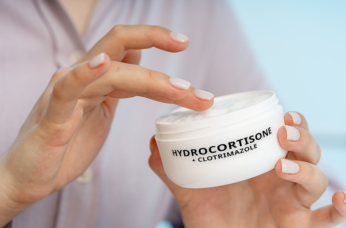 Hydrocortisone and clotrimazole medical cream, conceptual image Hydrocortisone and clotrimazole medical cream, conceptual image. A combination cream used to treat fungal skin infections with inflammation and itching, such as athlete s foot and jock itch., by Wladimir Bulgar SCIENCE PHOTO LIBRARY