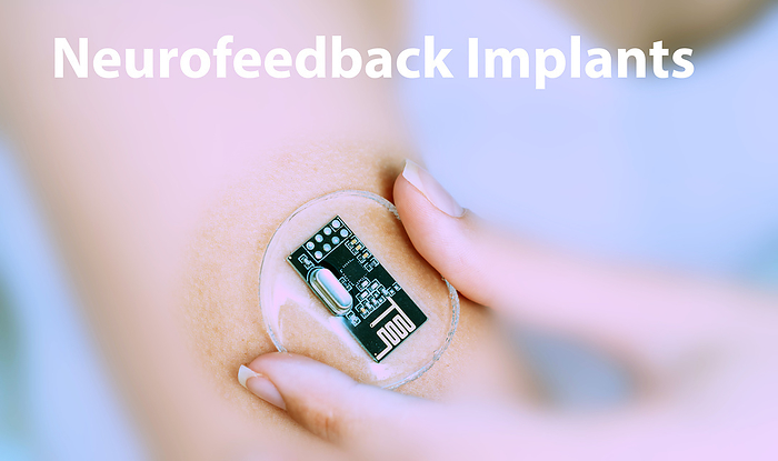 Neurofeedback implantable device, conceptual image Neurofeedback implantable device, conceptual image. Devices that provide real time feedback to the brain, helping individuals regulate their brain activity for various therapeutic purposes., by Wladimir Bulgar SCIENCE PHOTO LIBRARY
