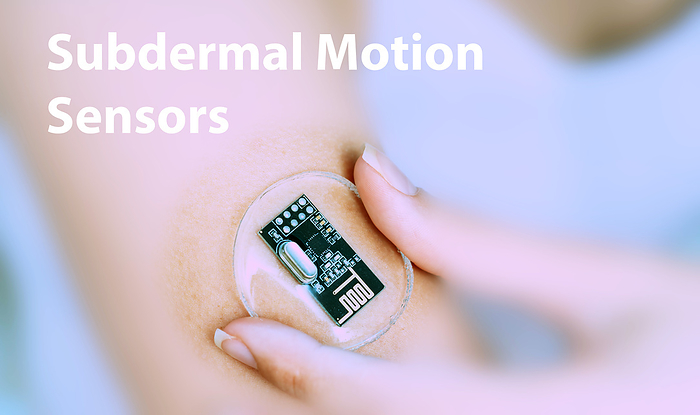 Subdermal motion sensors, conceptual image Subdermal motion sensors, conceptual image. Implantable sensors that detect and measure movement or motion patterns, assisting in monitoring physical activity or rehabilitation progress., by Wladimir Bulgar SCIENCE PHOTO LIBRARY