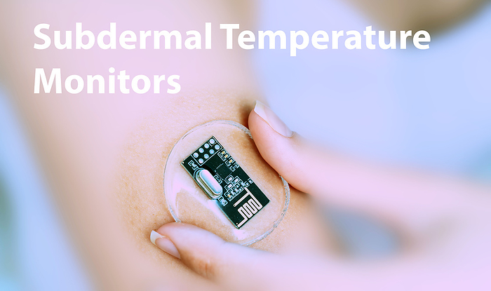 Subdermal temperature monitors, conceptual image Subdermal temperature monitors, conceptual image. Implantable sensors that continuously measure body temperature, assisting in monitoring fevers or temperature related conditions., by Wladimir Bulgar SCIENCE PHOTO LIBRARY