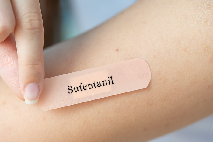 Sufentanil dermal patch, conceptual image Sufentanil transdermal patch, conceptual image. Potent opioid used for pain management., by Wladimir Bulgar SCIENCE PHOTO LIBRARY