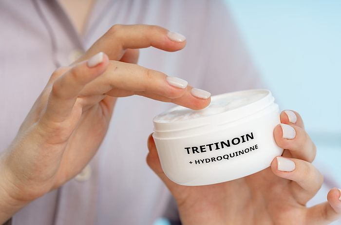 Tretinoin and hydroquinone medical cream, conceptual image Tretinoin and hydroquinone medical cream, conceptual image. A combination cream used to treat hyperpigmentation, acne scars, and uneven skin tone., by Wladimir Bulgar SCIENCE PHOTO LIBRARY