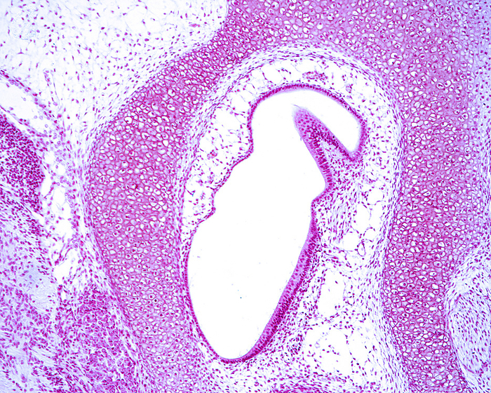 Developing inner ear, light micrograph Light micrograph showing a semicircular canal ampulla  top , with an ampullary crista, leading into the utricle, that shows the utricle macula. The bony labyrinth of the temporal bone is still in the cartilaginous stage, prior to ossification., by JOSE CALVO   SCIENCE PHOTO LIBRARY