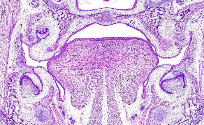 Rat embryo head, light micrograph Light micrograph of a frontal section of a rat embryo head showing the tongue, palate roof and teeth germs in the cap stage in the developing maxillae. Meckel s cartilage can be seen under the inferior tooth germs.