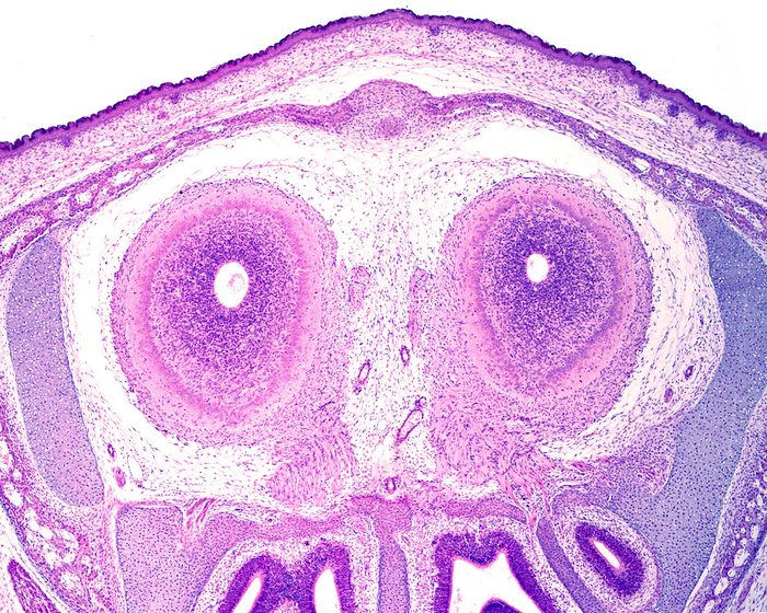 Developing olfactory bulb, light micrograph Light micrograph of the cross sectioned olfactory bulb of a rat embryo. It shows a small central lumen surrounded by a ventricular proliferating layer. The mitral cell and outer plexiform layers can already be recognised, as well as the olfactory nerve fibres directed toward the nasal cavity., by JOSE CALVO   SCIENCE PHOTO LIBRARY