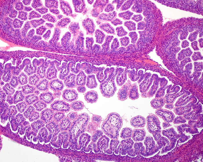 Foetal small intestine, light micrograph Light micrograph showing the small intestine of a rat foetus. The intestinal villi are already visible lined by a columnar epithelium., by JOSE CALVO   SCIENCE PHOTO LIBRARY