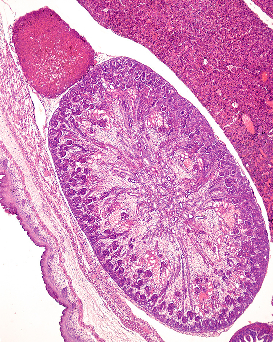 Developing kidney, light micrograph Light micrograph of the developing kidney of a rat embryo showing from outside to inside  a renal cortex with a peripheral hypercellular nephrogenic zone, developing glomeruli in S phase and glomeruli already with a Bowman s capsule. In the centre, there is an immature renal medulla with some tubules. Above the kidney, at top left, is a immature adrenal gland, by JOSE CALVO   SCIENCE PHOTO LIBRARY