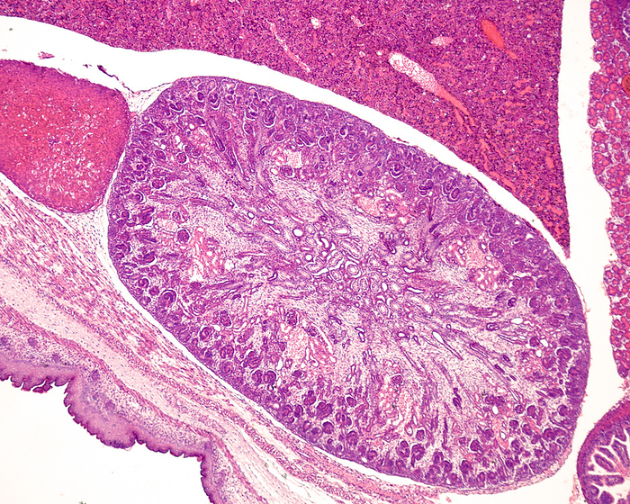 Developing kidney, light micrograph Light micrograph of the developing kidney of a rat embryo showing from outside to inside  a renal cortex with a peripheral hypercellular nephrogenic zone, developing glomeruli in S phase and glomeruli already with a Bowman s capsule. In the centre, there is an immature renal medulla with some tubules. Above the kidney, at top left, is a immature adrenal gland., by JOSE CALVO   SCIENCE PHOTO LIBRARY