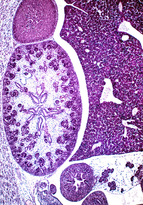 Developing kidney, light micrograph Light micrograph showing the abdomen of a rat embryo at 16 days of development. The liver is on the right and on the left is a developing kidney with a thin renal cortex and a large medulla. On top of the kidney a developing adrenal gland can be seen., by JOSE CALVO   SCIENCE PHOTO LIBRARY