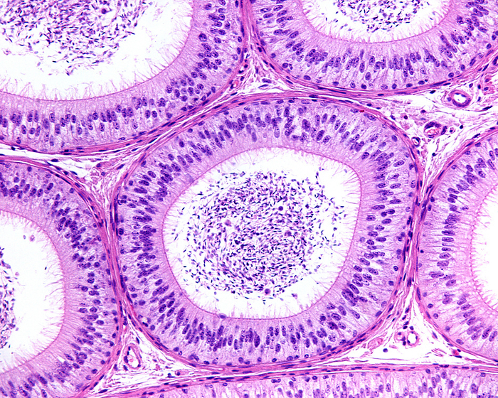Epididymis pseudostratified epithelium, light micrograph Light micrograph of epididymal ducts lined by pseudostratified columnar epithelium with tall columnar principal cells showing stereocilia and basal cells. The function of the epididymis is the storage, maturation and transport of sperm cells. During their transit in the epididymis, sperm undergo maturation processes necessary to acquire motility and fertility., by JOSE CALVO   SCIENCE PHOTO LIBRARY