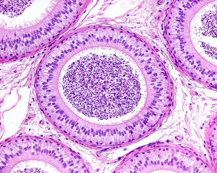 Epididymis pseudostratified epithelium, light micrograph Light micrograph of epididymal ducts lined by pseudostratified epithelium with tall columnar principal cells showing stereocilia and basal cells. The function of the epididymis is the storage, maturation and transport of sperm cells. During their transit in the epididymis, sperm undergo maturation processes necessary to acquire motility and fertility., by JOSE CALVO   SCIENCE PHOTO LIBRARY