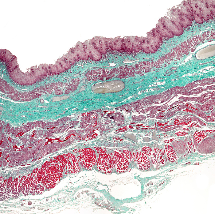 Human oesophagus, light micrograph Light micrograph of a human oesophagus showing, from top, mucosa lined by a stratified squamous epithelium, lamina propria, muscularis mucosae, submucosa, two muscular layers and adventitia. With Masson trichrome stain, the connective  green  and muscular tissue  light purple  differentiate well., by JOSE CALVO   SCIENCE PHOTO LIBRARY