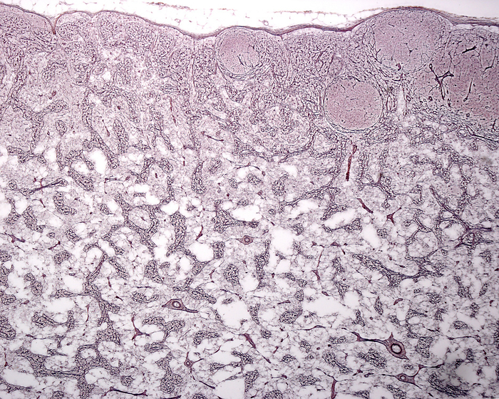 Lymph node reticular fibres, light micrograph Light micrograph of a lymph node stained with a silver technique for reticular fibres. The capsule and trabeculae appear as thin black lines. The reticular meshwork of reticular fibres can be seen in the lymph node cortex and medulla. The round clear spaces of the cortex  top  are the germinal centres of secondary follicles., by JOSE CALVO   SCIENCE PHOTO LIBRARY