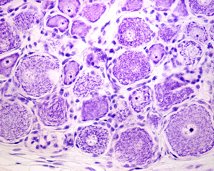 Dorsal root ganglion, light micrograph Light micrograph showing neurons  nerve cells  in a dorsal root ganglion stained with cresyl violet. They are pseudounipolar neurons of rounded soma showing small, thin Nissl bodies characteristic of sensitive neurons and a large nucleus with a prominent nucleolus. Each cell body is surrounded by small dense nuclei corresponding to glia cells called satellite cells., by JOSE CALVO   SCIENCE PHOTO LIBRARY