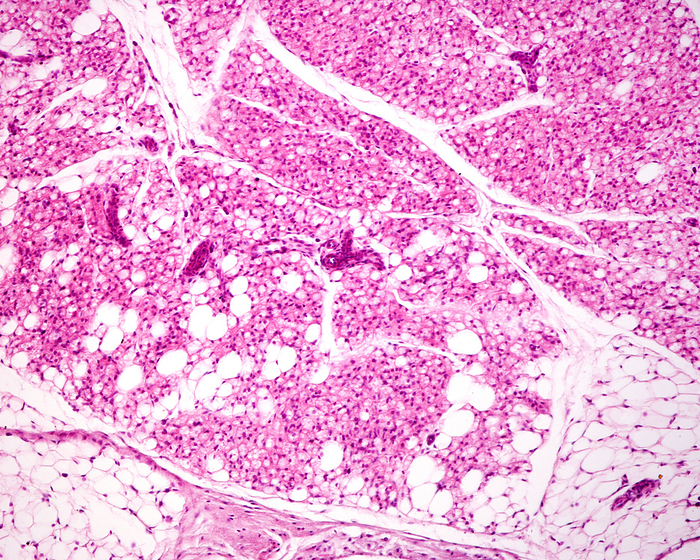 Brown and white fat, light micrograph Light micrograph showing interscapular brown adipose  fat  tissue. Brown fat is very developed in rodents and hibernating animals. Brown adipocytes show a spongy eosinophilic aspect because they store fat as small lipid droplets. Brown and white adipose tissue are often mixed and, with time, there is a gradual transformation of brown into white fat., by JOSE CALVO   SCIENCE PHOTO LIBRARY