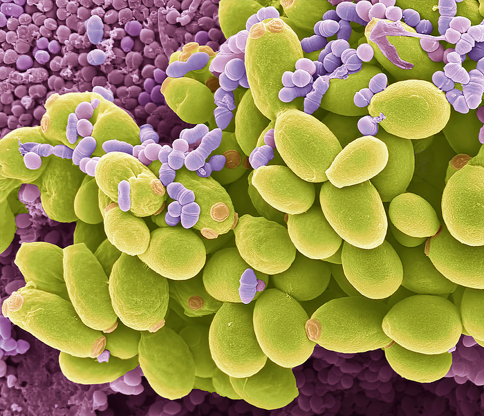 Yeast in a faecal culture, SEM Yeast in a faecal culture. Scanning electron micrograph  SEM  of bacteria and yeast cultured from a sample of human faeces. Although yeast are normal bowel flora and recovery of low numbers in stool cultures is common, some hospitalized patients exhibit large numbers of yeast in stools, Environmental changes in the body, certain health issues, and the use of antibiotics can encourage the growth of Candida. If there is an overgrowth of Candida, it can cause an infection called candidiasis. Magnification: x3000 when printed at 10 centimetres wide., by STEVE GSCHMEISSNER SCIENCE PHOTO LIBRARY