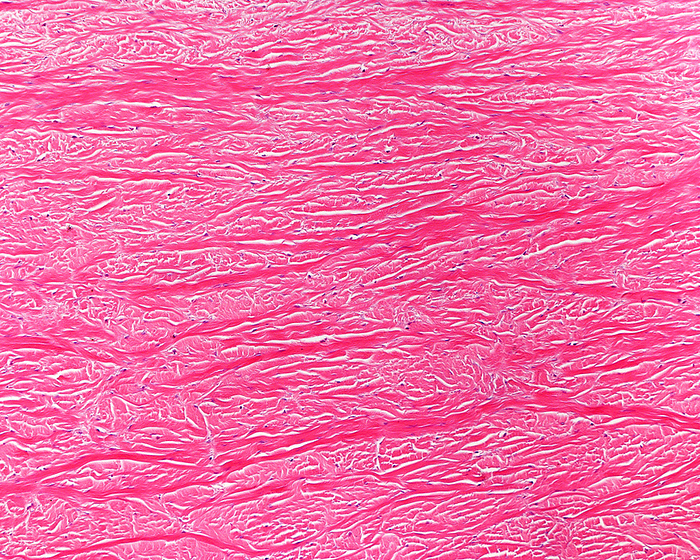 Sclera, light micrograph Sclera, light micrograph. The sclera, or white of the eye, is a dense connective tissue made of mainly type I collagen fibres, oriented in different directions. The lack of parallel orientation of the collagen fibres gives the sclera its white appearance, as opposed to the transparent nature of the cornea., by JOSE CALVO   SCIENCE PHOTO LIBRARY