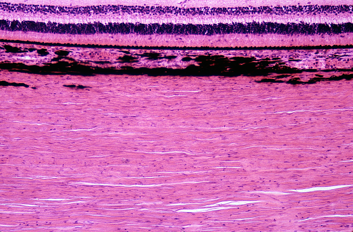 Human eyeball layers, light micrograph Light micrograph of the layers of the eyeball showing, from bottom, the sclera, the choroid stroma with blood vessels and many pigment cells, the choriocapillaris  a single layer of blood capillaries , and layers of retina from pigment epithelium to the inner plexiform nerve fibre layer., by JOSE CALVO   SCIENCE PHOTO LIBRARY