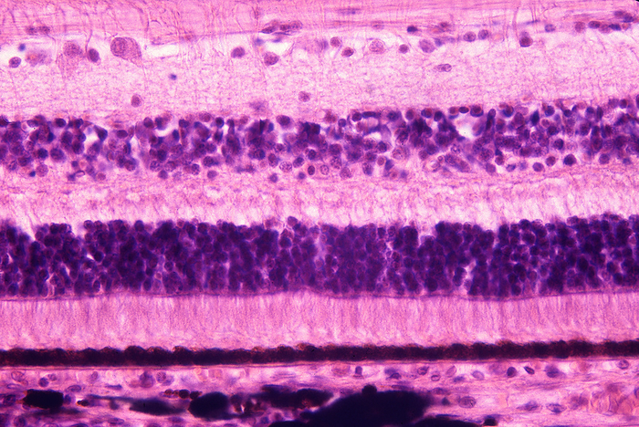 Human retina, light micrograph Light micrograph of a human retina. From top to bottom the retina layers are: nerve fibre layer, ganglion cell layer, inner plexiform layer, inner nuclear layer, outer plexiform layer, outer nuclear layer, rods and cones, and pigment epithelium layer., by JOSE CALVO   SCIENCE PHOTO LIBRARY