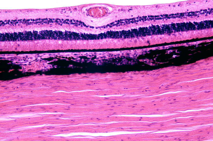 Human eyeball layers, light micrograph Light micrograph of the layers of the eyeball showing, from bottom, the sclera, the choroid with blood vessels and many pigment cells, the choriocapillaris  a single layer of blood capillaries  and the layers of retina from pigment epithelium to nerve fibre layer  showing a retinal blood vessel ., by JOSE CALVO   SCIENCE PHOTO LIBRARY