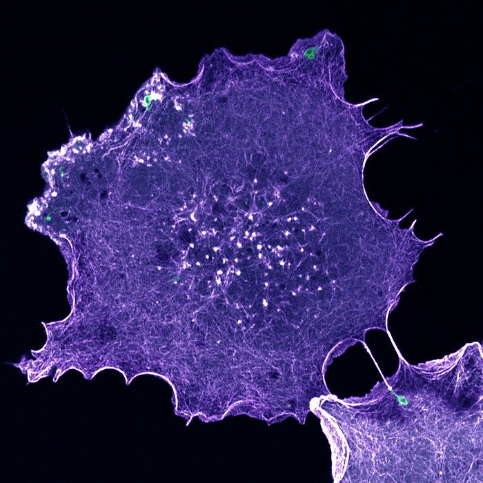 Actin cytoskeleton, confocal light micrograph Confocal light micrograph of a fibroblast like cell extracted from the African green monkey  Cercopithecus aethiops . The cell is expressing a fluorescent protein that labels actin filaments, which make up part of the cytoskeleton purple. The cytoskeleton maintains the cell s shape, allows some cellular mobility and is involved in intracellular transport. The green areas are the location of endocytic events, where substances from outside are taken inside the cell. These events are marked by another fluorescence protein. See K013 0816 for video version., by THEBIOCOSMOS SCIENCE PHOTO LIBRARY