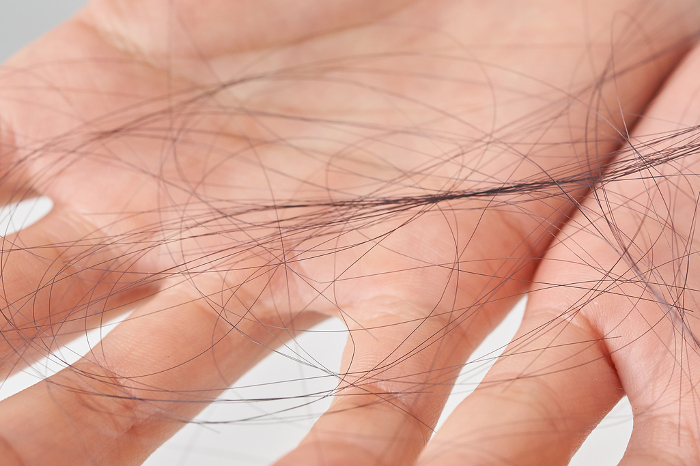 Hand of a woman with a head of hair that has fallen out