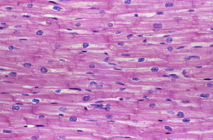 Human heart muscle Light micrograph of a section of normal human heart  cardiac  muscle. It is composed of spindle  shaped cells grouped in irregular bundles. Boundaries between individual cells are faintly visible here. Each cell contains one nucleus per cell, visible as a dark stained spot. Cardiac muscle is a specialised muscle tissue that can contract regularly and continuously without tiring. Magnification: x100 at 35mm size.
